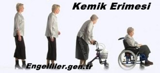kemik erimesi.jpg kemik erimesi.jpg