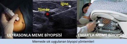 biyopsi-yöntemleri.jpg biyopsi-yöntemleri.jpg