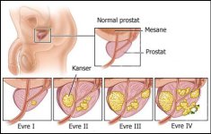 endoskopik-tumor-tedavileri_clip_image022.jpg