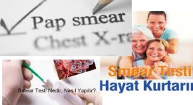 Smear-Testi.jpg Smear-Testi.jpg