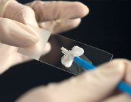 smear-testi.jpg smear-testi.jpg