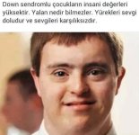 Down-Sendromlu-Çocuklar.jpg