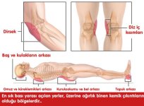 psore9.jpg psore9.jpg