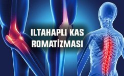 iltahaplı-kas-romatizması.jpg iltahaplı-kas-romatizması.jpg